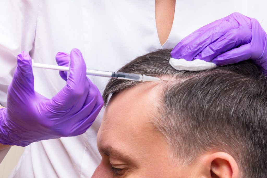Laser Hair Reduction